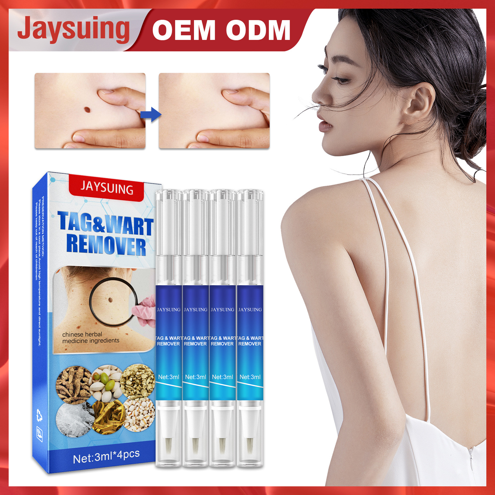 Free freight Jaysuing OEM ODM Nevus removing nursing pen for removing warts, condyloma acuminatum, flat meat thorn for removing filamentous
Free freight Jaysuing OEM ODM Nevus removing nursing pen for removing warts, condyloma acuminatum, flat meat thorn for removing filamentous