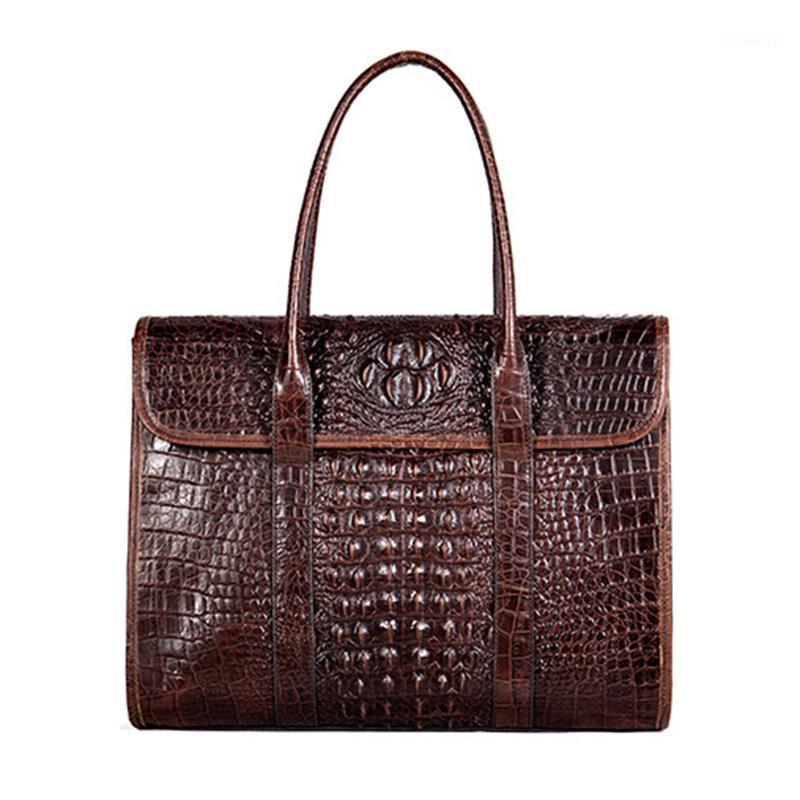 Famous design Crocodile pattern men's bag The first Layer Cowhide leather totes bag handbag large capacity business briefcase1, Dark coffee
Famous design Crocodile pattern men's bag The first Layer Cowhide leather totes bag handbag large capacity business briefcase1, Dark coffee