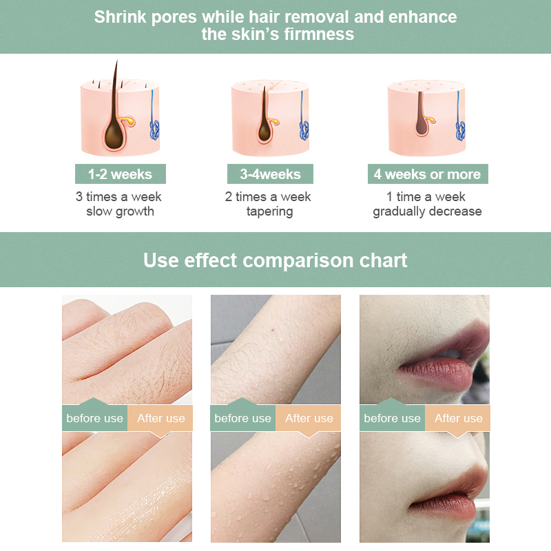 999999 Flash Photoepilator Whole Body IPL Hair Removal Laser Epilator For Women Painless Threading Laser Hair Removal Machine Ra
999999 Flash Photoepilator Whole Body IPL Hair Removal Laser Epilator For Women Painless Threading Laser Hair Removal Machine Ra