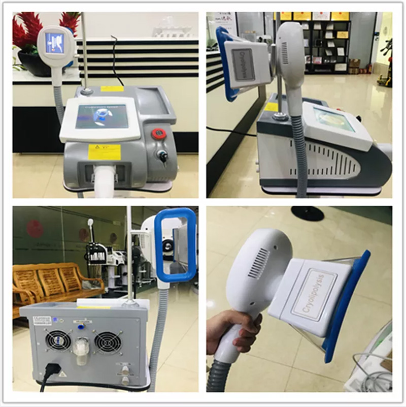 New model single 1 cryo handle fat freeze portable cryolipolysis machine