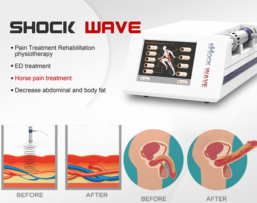 Home Use Erectile Dysfunction Acoustic Wave Therapy Machine For ED Treatment Low intensity Shockwave Therapy Machine For Ed
Home Use Erectile Dysfunction Acoustic Wave Therapy Machine For ED Treatment Low intensity Shockwave Therapy Machine For Ed