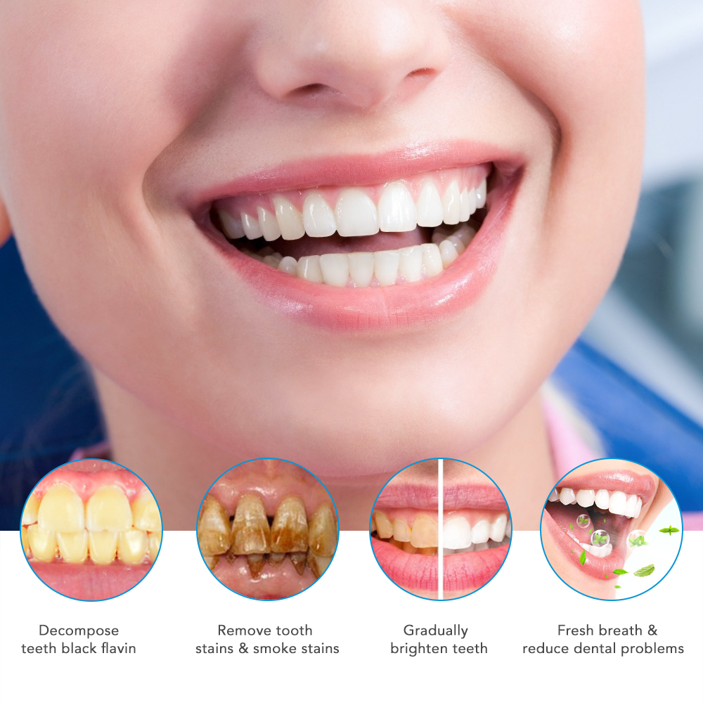 LED Teeth Whitening Kit 4 PCS Tooth Whitener Pen 35% Carbamide Peroxide Gel Dental Bleaching System Mouth Trays Tooth Machine