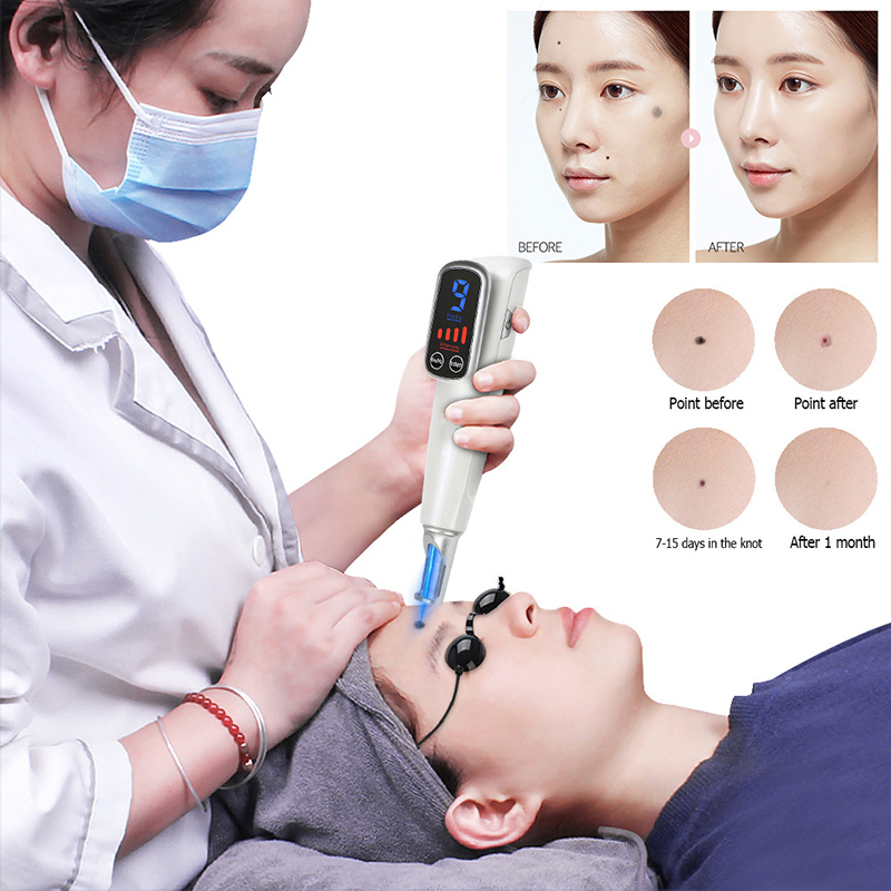 LCD Picosecond Laser Pen Light Therapy Tattoo Scar Mole Freckle Removal Dark Spot Remover Machine Skin Care Beauty Device Raben
LCD Picosecond Laser Pen Light Therapy Tattoo Scar Mole Freckle Removal Dark Spot Remover Machine Skin Care Beauty Device Raben
