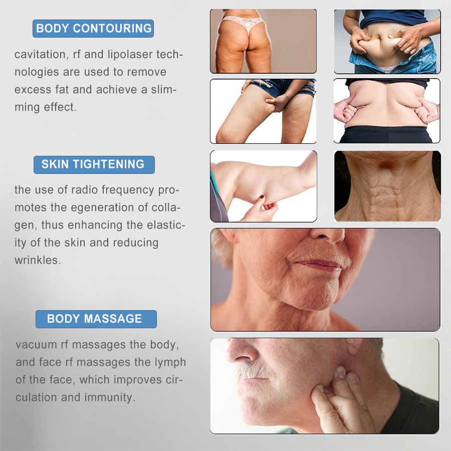 6 in 1 Rf Cavitation 40K Vacuum Beauty Machine To Lose Weight S Shape Lipo Laser Pads Portable S Shape Slimming Machine