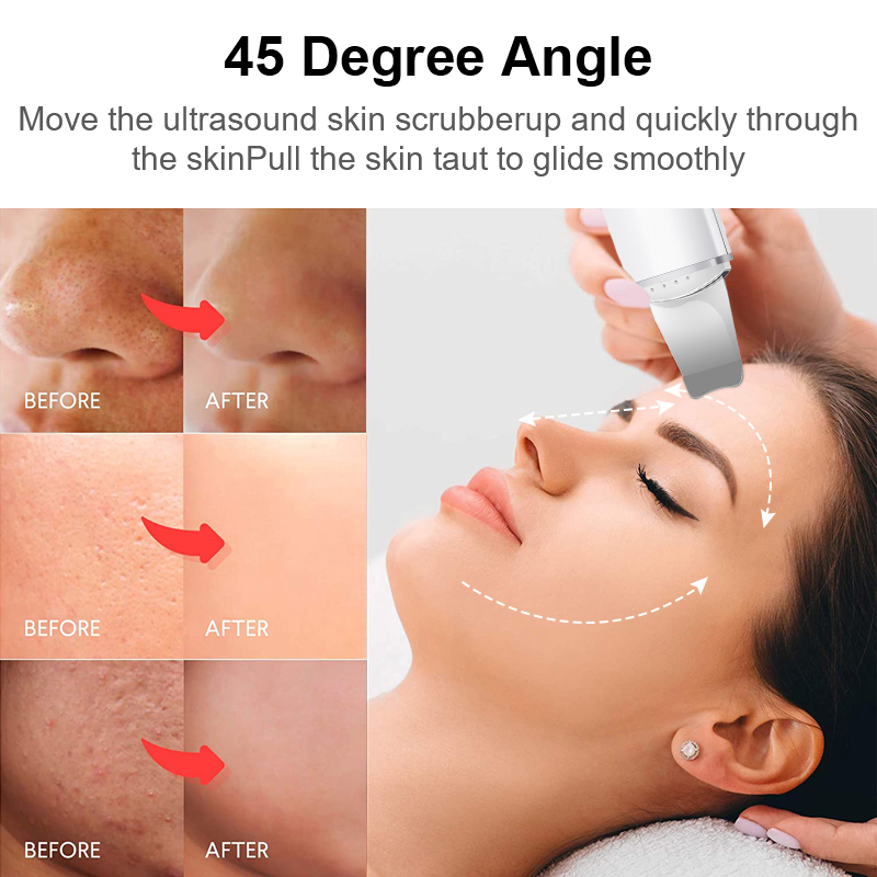 Ultrasonic Skin Scrubber Blackhead Remover Face Scrubber Cleanser Facial Pore Cleaner Face Lifting USB Face Skin Scraper Peeling 210304