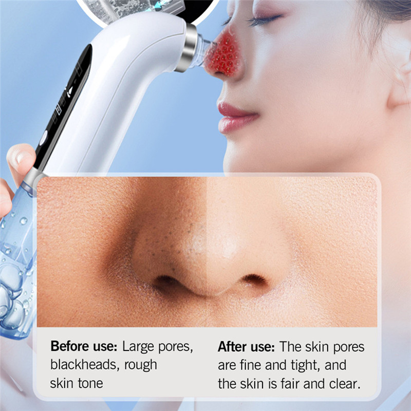Electric Blackhead Remover Facial Vacuum Pore Blackhead Cleaner Small Bubble Water Cycle Acne Pimple Clean Beauty Skin Care Tool Limpiador De Espinill