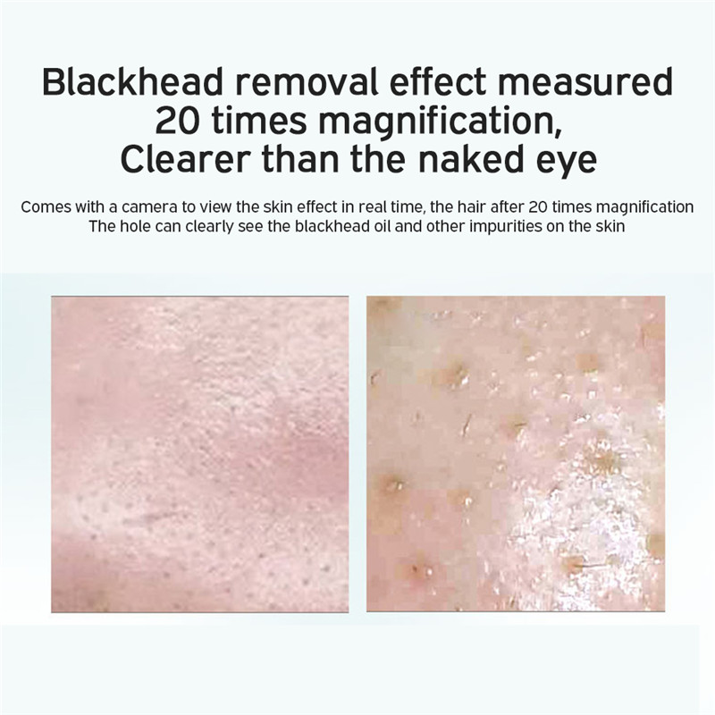 USB Rechargeable Visual Blackhead Remover Pore Cleaner WIFI Microscope Camera Vacuum Suction Deep Nose Cleasning Pimple Removal Limpiadora De Poros