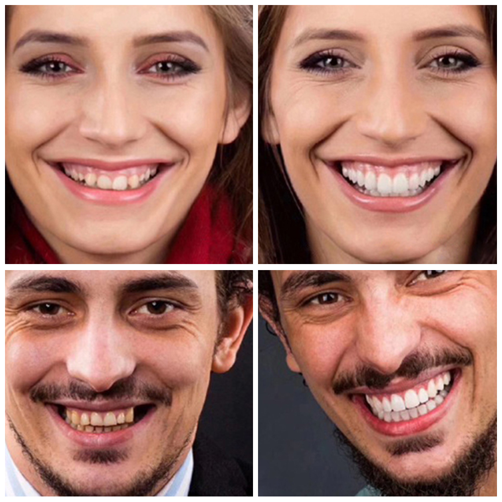 LED Teeth Whitening Kit 4 PCS Tooth Whitener Pen 35% Carbamide Peroxide Gel Dental Bleaching System Mouth Trays Tooth Machine