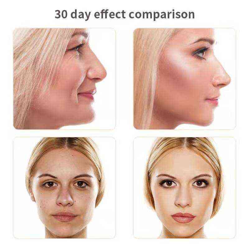 NXY Face Care Devices Ems Eye Massager Anti Wrinkle Massage Aging Usb Rechargeable for Face Electric Dark under Circles Remove 0222