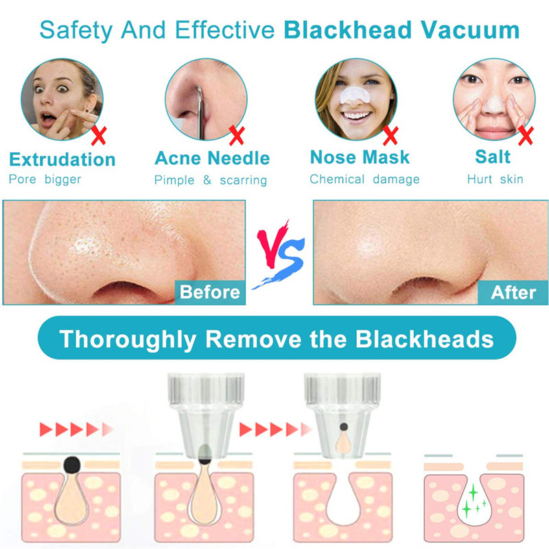 USB Rechargeable Visual Blackhead Remover Pore Cleaner WIFI Microscope Camera Vacuum Suction Deep Nose Cleasning Pimple Removal Limpiadora De Poros