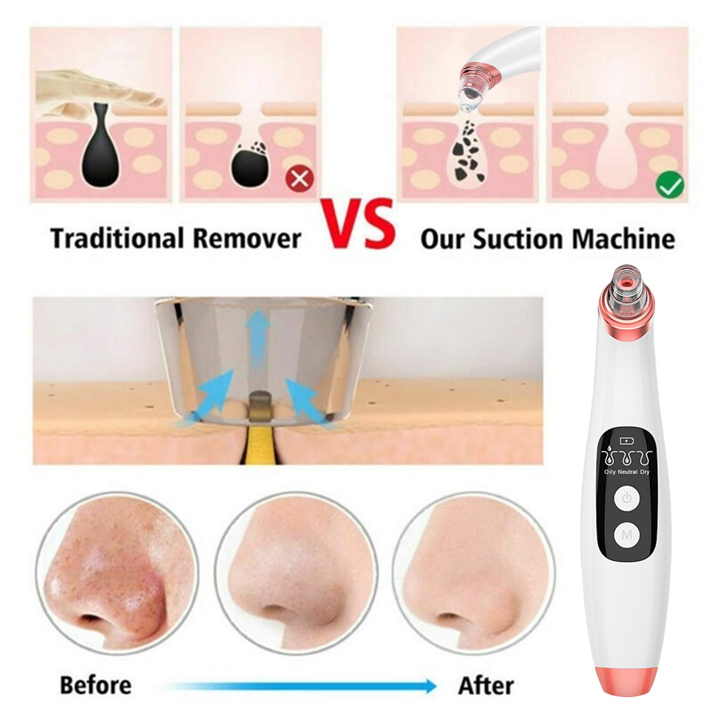 Blackhead Remover with Camera LCD Face Pore Cleaner Nose T Zone Acne Pimple Removal Tool Blackhead Vacuum Suction Skin Care 210304