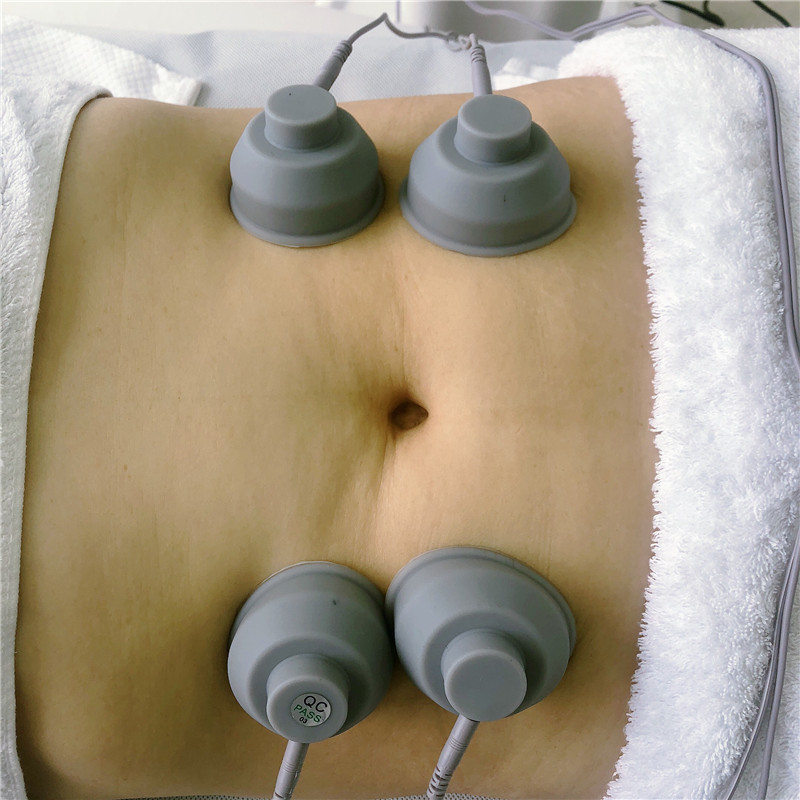 Cellulite Reduce Electrical Muscle Stimulation Machine With 4 Pieces Vacuum Cups shockwave therapy for pain relief
Cellulite Reduce Electrical Muscle Stimulation Machine With 4 Pieces Vacuum Cups shockwave therapy for pain relief