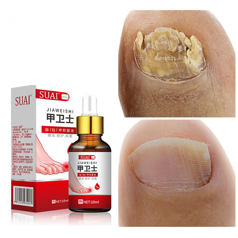yutong Nail Fungal Treatment Feet Care Essence Foot Whitening Toe Fungus Removal Gel Anti Infection Paronychia Onychomycosis
yutong Nail Fungal Treatment Feet Care Essence Foot Whitening Toe Fungus Removal Gel Anti Infection Paronychia Onychomycosis