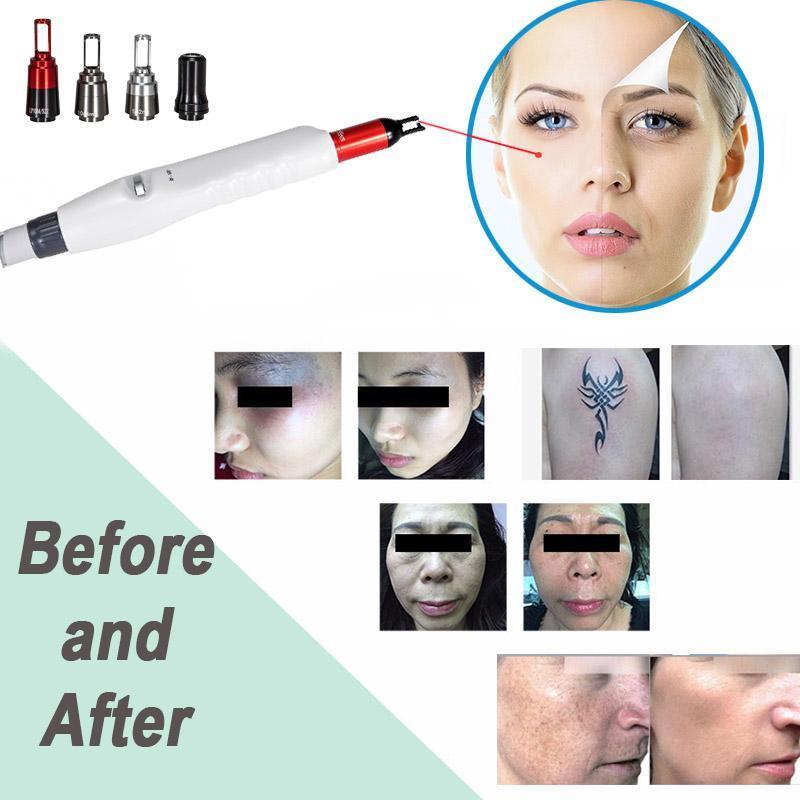 Beauty Machine For Tattoo Removal Best quality portable laser tattoo removal machine