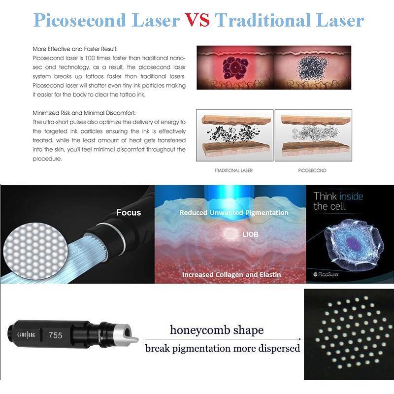 tattoo Removal Machine 1064nm 532nm 755mm 1320nm PicoS Laser Ance Remove Skin Rejuvenation Beauty Equipment