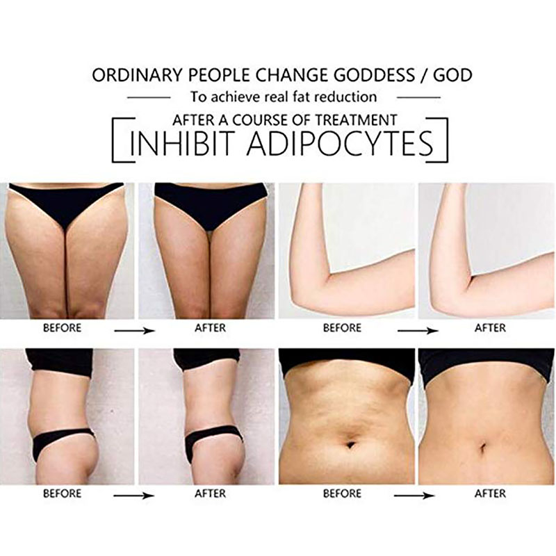 Slimming Machine Lipo Laser 650Nm Lllt 14 Pads Laser Body Slim Cellulite Removal Machine Get Free Gift