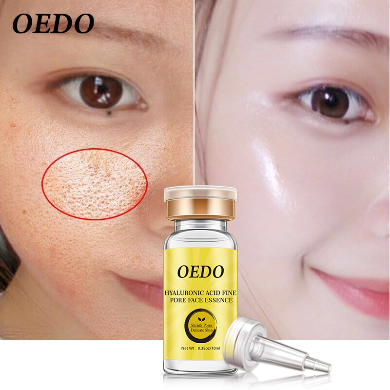 OEDO Shrink Pores Hyaluronic Acid liquid Moisturizing Face Serum Whitening Plant Skin Care Anti Aging Anti Wrinkle Cream 10ml
OEDO Shrink Pores Hyaluronic Acid liquid Moisturizing Face Serum Whitening Plant Skin Care Anti Aging Anti Wrinkle Cream 10ml