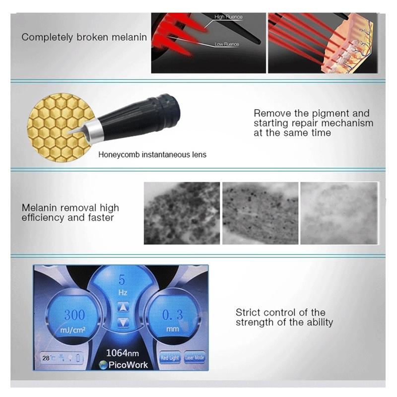 tattoo Removal Machine 1064nm 532nm 755mm 1320nm PicoS Laser Ance Remove Skin Rejuvenation Beauty Equipment
