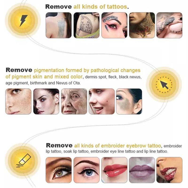 Picosecond for All Skin Type Tattoo Removal Q Switch Laser 1064nm 532nm 755nm Tatoo Pigment freckle sun spot Remoel Machine
