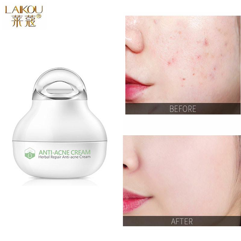 FENYI Herbal Acne Scar Removal Serum Creams Acne Treatment Face Cream Oil Control Shrink Pores Anti Acne Redness Skin Care 8g
FENYI Herbal Acne Scar Removal Serum Creams Acne Treatment Face Cream Oil Control Shrink Pores Anti Acne Redness Skin Care 8g