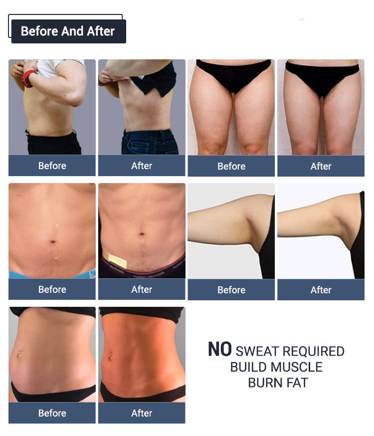 body shaping machine emt Stimulate Muscles slimming devcie no downtime muscle stimulator Focused Electromagnetic