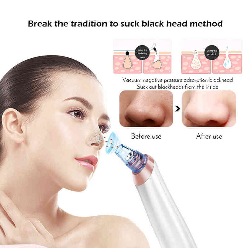 NXY Face Care Devices Face Nose Acne Black Dot Pimple Blackhead Remover Electric Vacuum Cleaner Pore Skin Care Tools Machine 0222