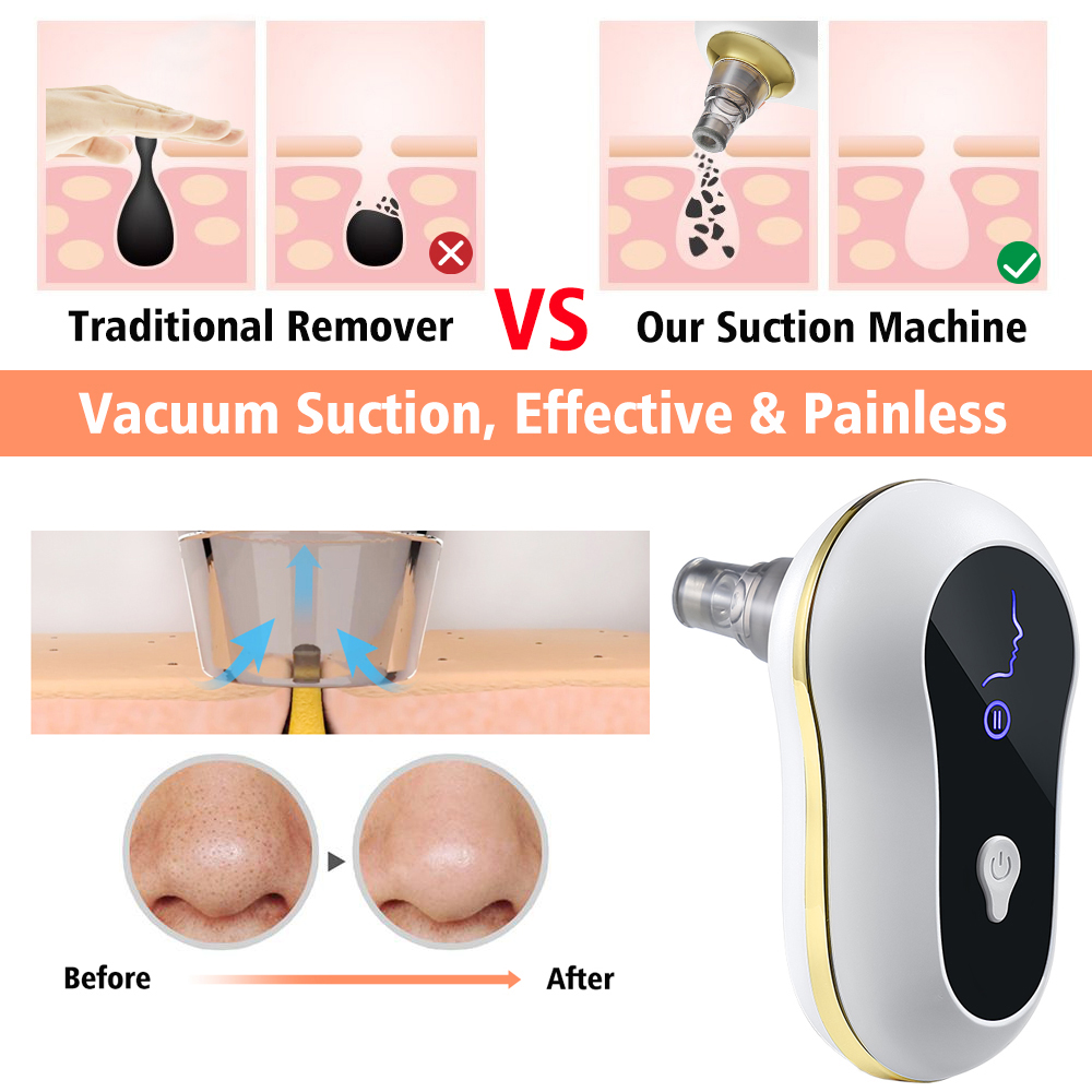 Blackhead Remover Vacuum T Zone Pore Acne Pimple Removal Vacuum Suction Face Deep Nose Cleaner Facial Diamond Face Pore CleanScouts
Blackhead Remover Vacuum T Zone Pore Acne Pimple Removal Vacuum Suction Face Deep Nose Cleaner Facial Diamond Face Pore CleanScouts