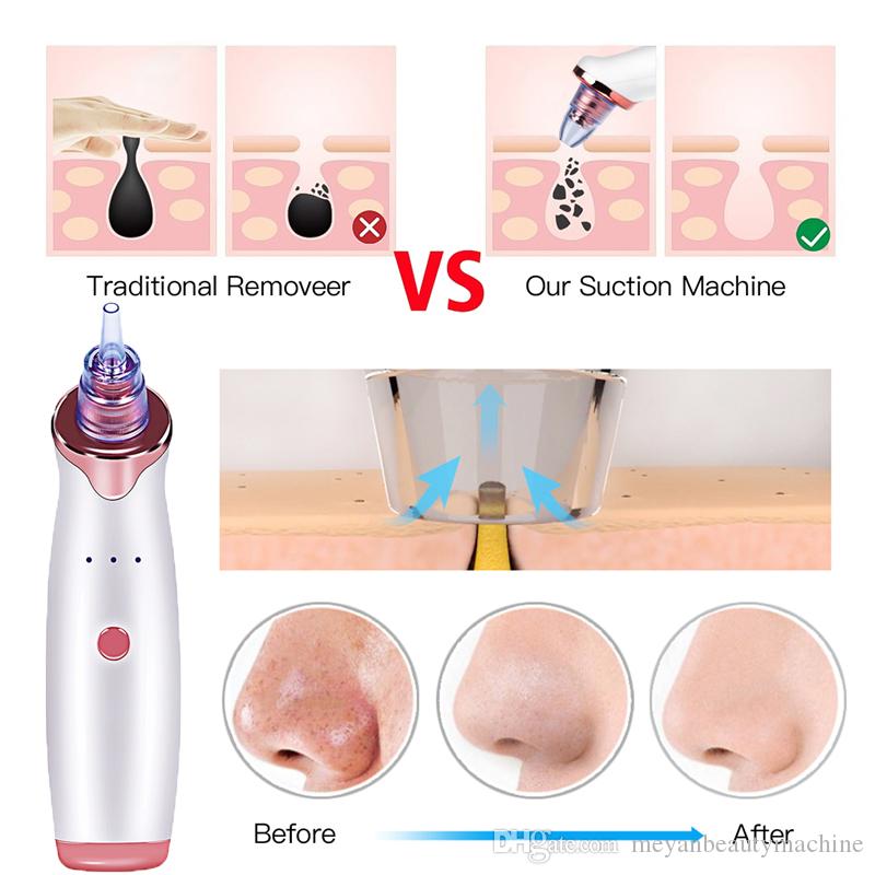 Diamond Microdermabrasion Beauty Machine Pore Vacuum Blackhead Remover Suction Acne Peeling Face Cleanser Facial Skin Care