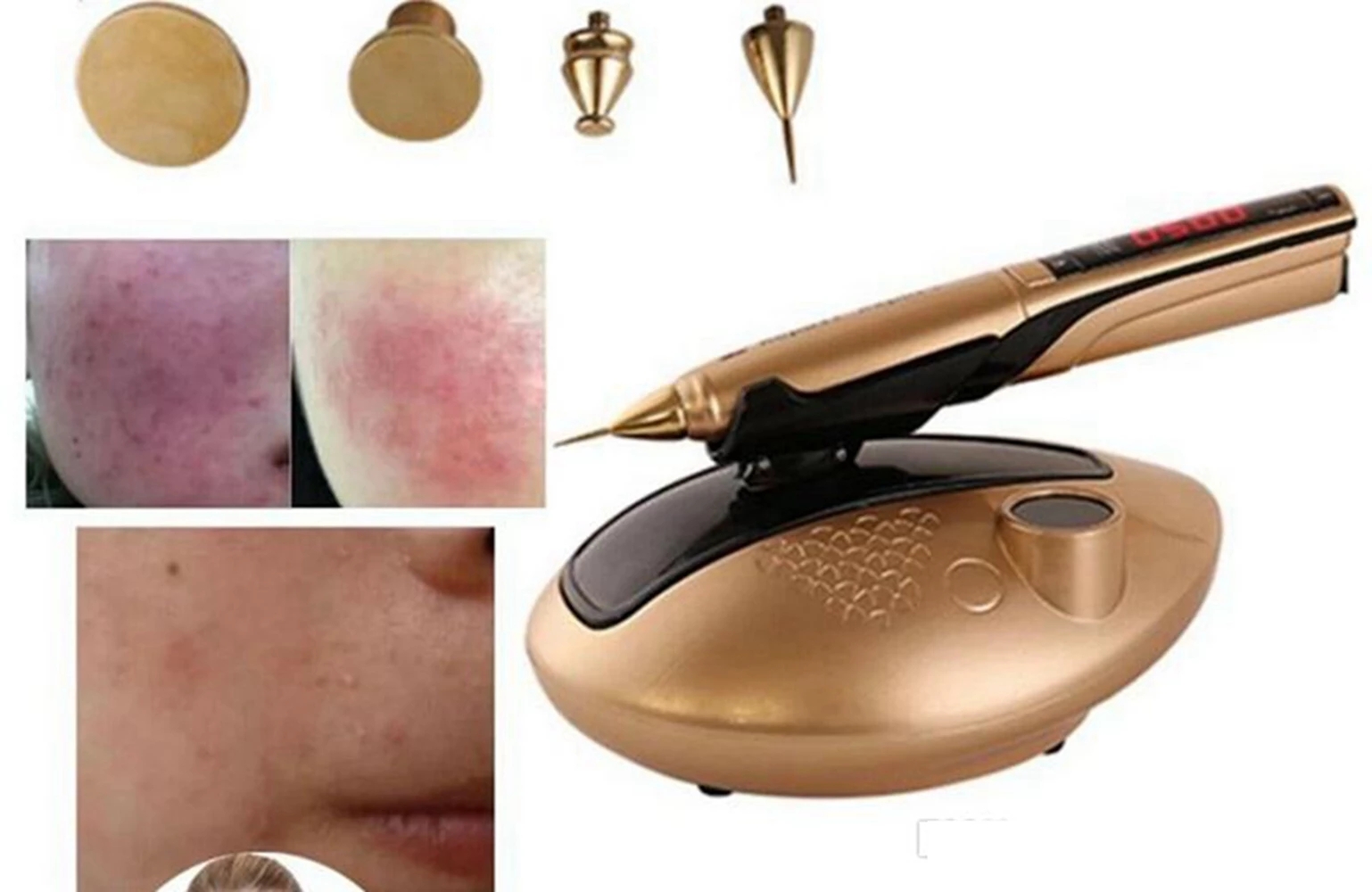 Other Beauty Equipment cold plasma surgical device Tattoo Freckle Wart Tag Removal Pen Laser Mole Remove Remover system Face Care Skin Care Tools Machine on sale