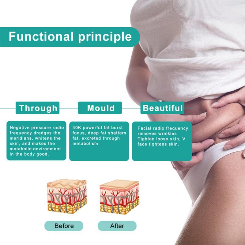 80K Cavitation Vacuum Fat Removal Slimming Machine Weight Loss Ultrasonic Radio Frequency Therapy Body Shaping Equipment