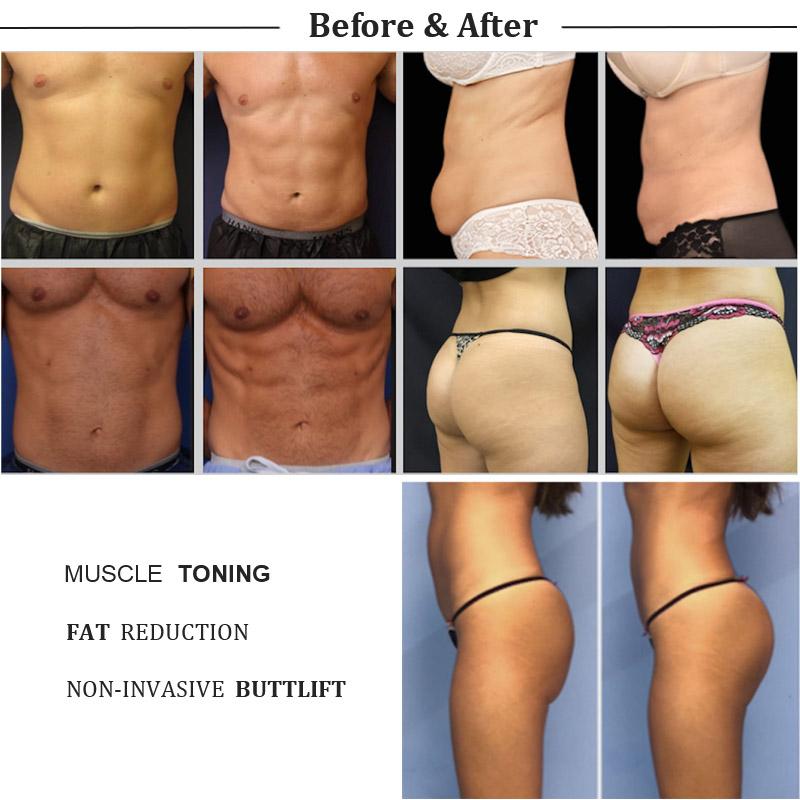 2022 EMslim HI-EMT machine body shaping fat burning 7 Tesla beauty equipment EMS electromagnetic Muscle Stimulation bulit