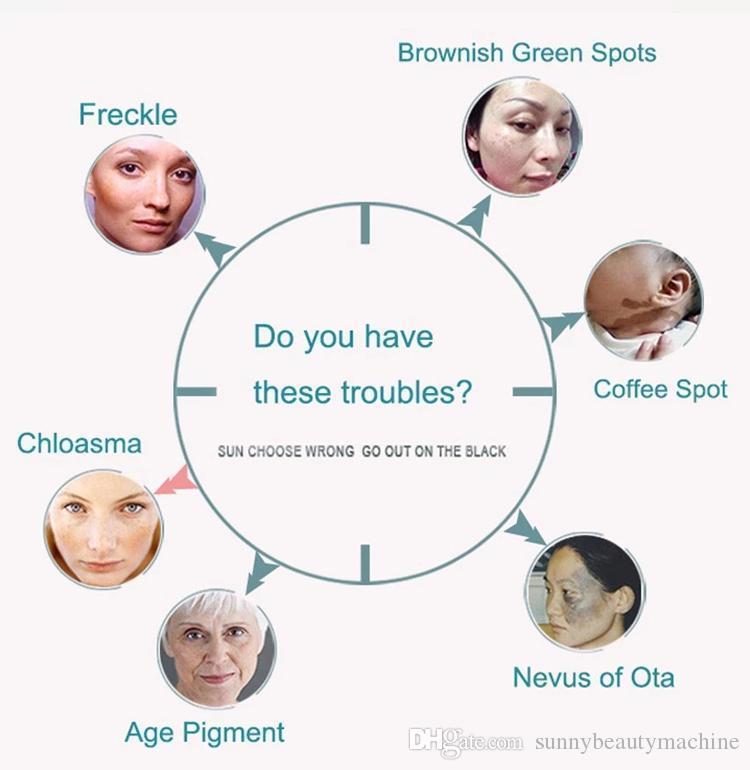 Safty Laser Beauty ND YAG tattoo removal machine 755 1320 1064 532nm picosecond freckle reduce equiment