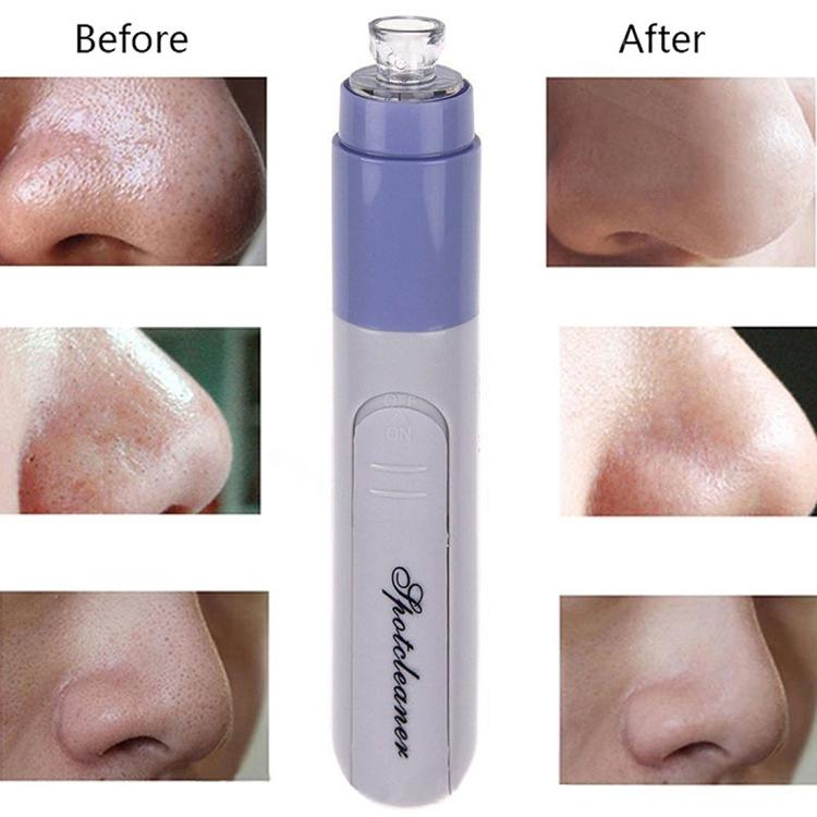 OEM/ODM Wholesale Face Pore Cleaner Face Dirt Suck Acne Pimple Blackheads Remover Electric Vacuum Tool