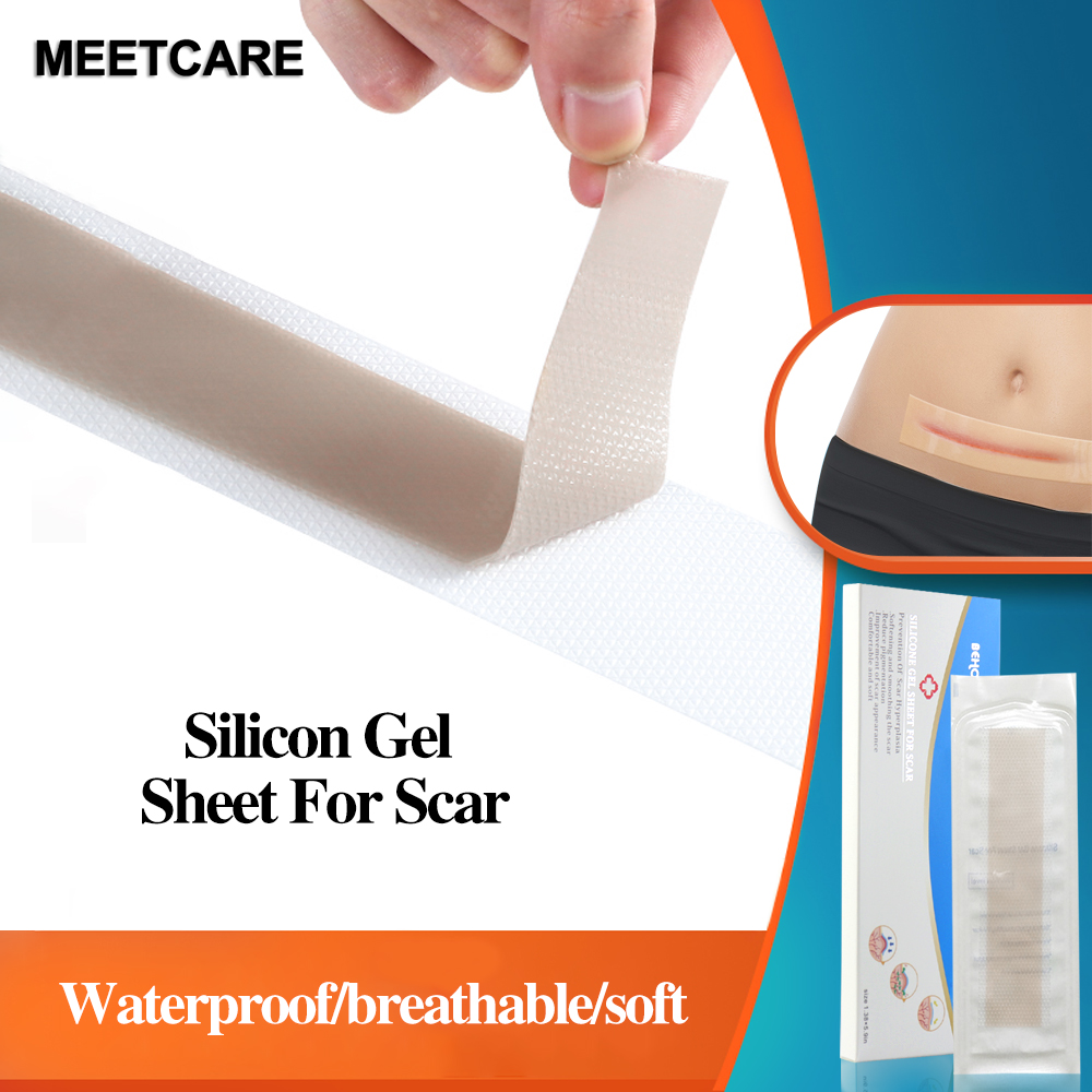 Efficient Caesarean section surgery Silicone Gel Removal Scar Sheet Therapy Patch for Acne Trauma Burn Skin Repair, Skin color
Efficient Caesarean section surgery Silicone Gel Removal Scar Sheet Therapy Patch for Acne Trauma Burn Skin Repair, Skin color