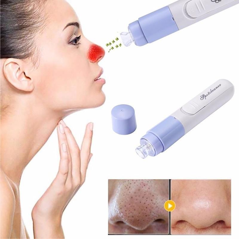 OEM/ODM Wholesale Face Pore Cleaner Face Dirt Suck Acne Pimple Blackheads Remover Electric Vacuum Tool