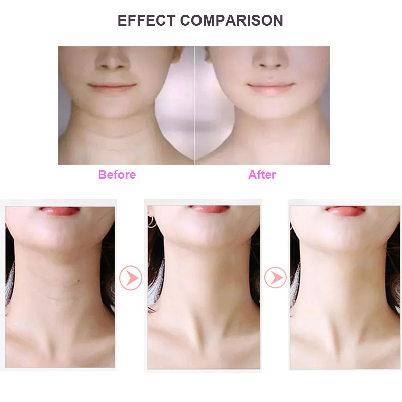 Neck Face Massager LED Photon Therapy Reduce Wrinkles Ultrasonic Vibration Roller Beauty Products USB Charging Skin Care Tool Ra
Neck Face Massager LED Photon Therapy Reduce Wrinkles Ultrasonic Vibration Roller Beauty Products USB Charging Skin Care Tool Ra