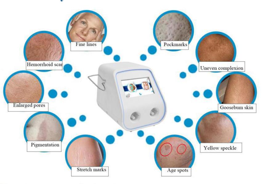 Tixel Thermal Fractional Skin Rejuvenation Pigment Scar Stretch Wrinkle Removal Machine with 2 Handles Beauty Equipment