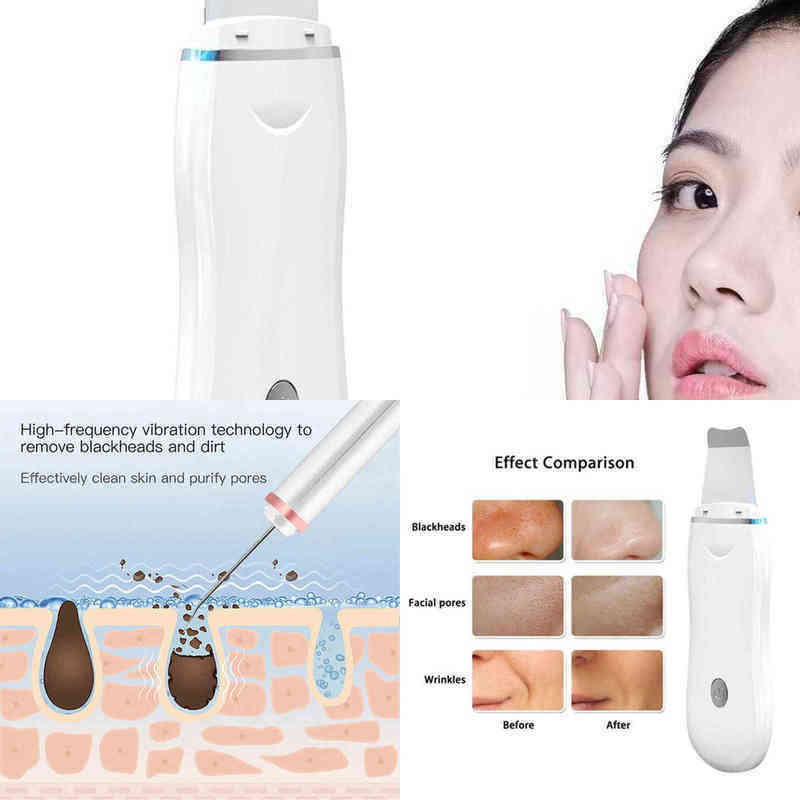 Nxy Face Care Devic… - image