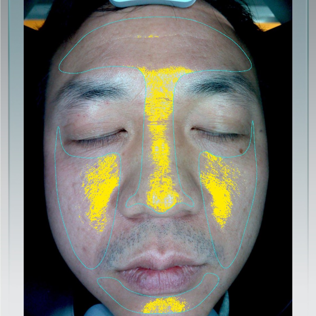 2022 Professional Digital Magic 3D Analyze Facial Machine Skins Analysis Scanner With Pad Facial Skin Analyzer Machines