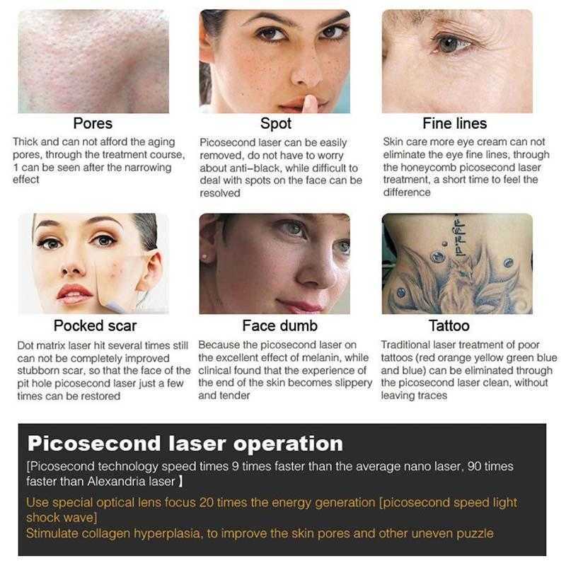 Salon use Nd yag Laser Machine Tattoo Removal and Pigmentation treatment 755 1064 532nm