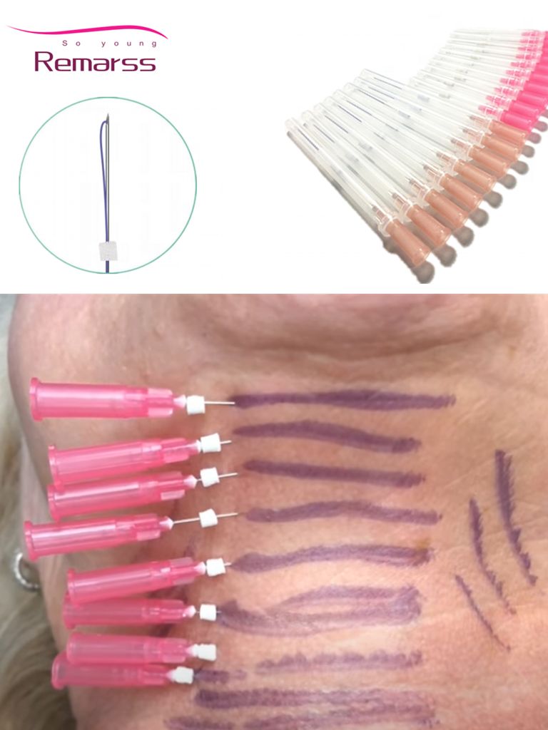 Pdo Thread mono screw needle 30g 29g 27g 26g 25mm 13mm 50mm 60mm 90mm For Eye Face Lifting with good effect
Pdo Thread mono screw needle 30g 29g 27g 26g 25mm 13mm 50mm 60mm 90mm For Eye Face Lifting with good effect