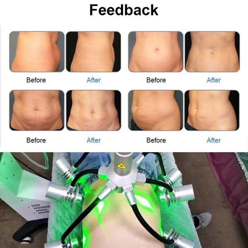6D Lipolaser Shape Body Slimming Machine 532nm Green Wavelength Laser Power Slimming Beauty Equipment For Body Treatment
