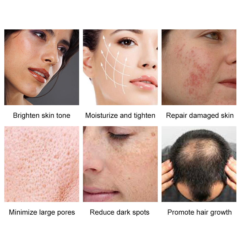 LED Skin Rejuvenation 7 Color Spectrometer PDT Facial Light Therapy Machine with Facial Steamer and Laser Hair Growth