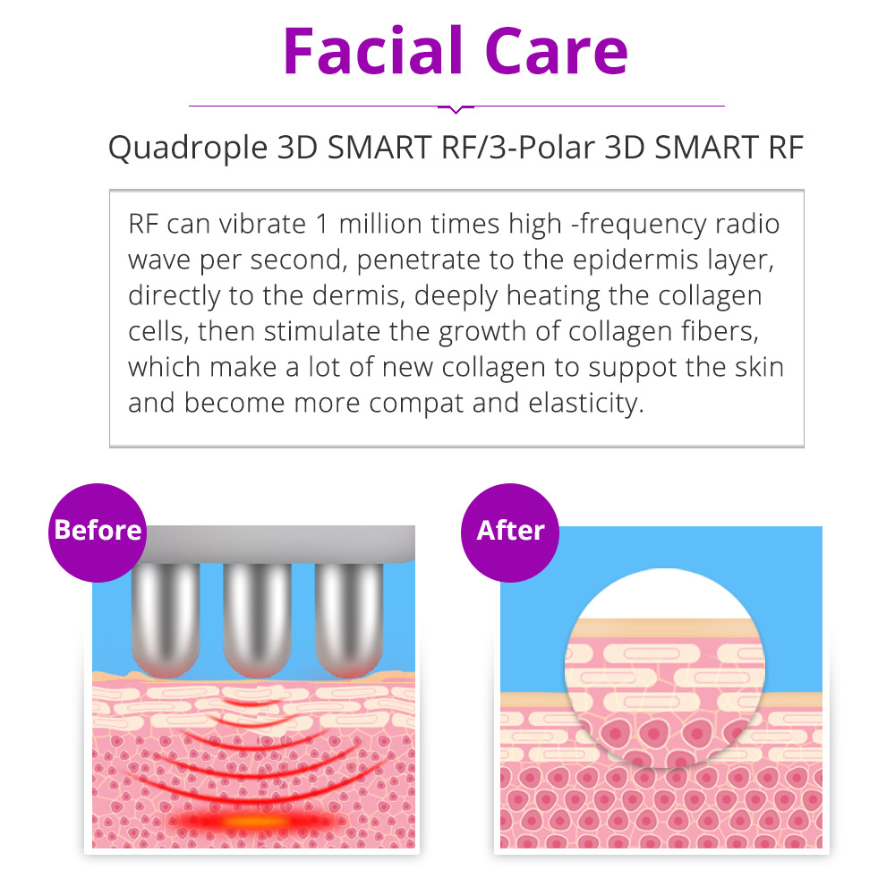 Ultrasonic 6 in 1 Cavitation 2.0 RF Radio Frequency Fat Burning Lipolaser Cellulite Reduction Machine