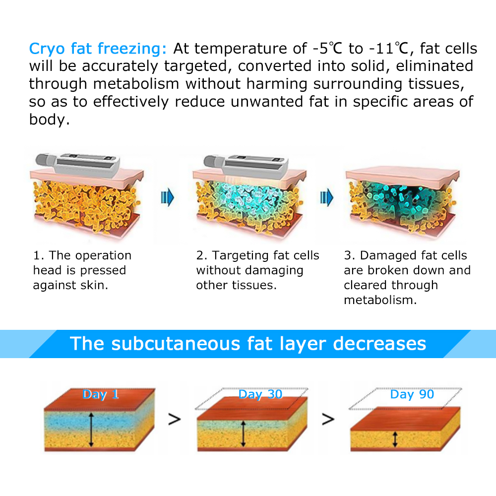 Cryo Therapy Machine 8 Handles Cryo Slimming Machine Fat Freezing Machine