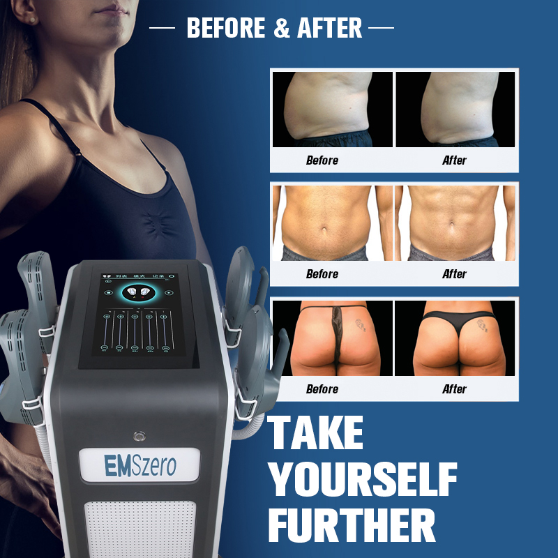 emslim body slimming technology massage machines for sale focused electromagnetic muscle building equipment
