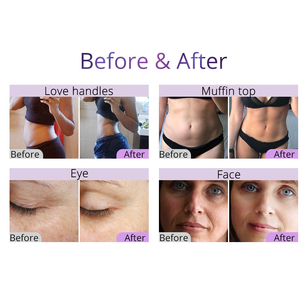 2022 Radio Frequency Bipolar Slimming Machine Ultrasonic Cavitation Cellulite Removal Vacuum Weight Loss Health Beauty Equipmet