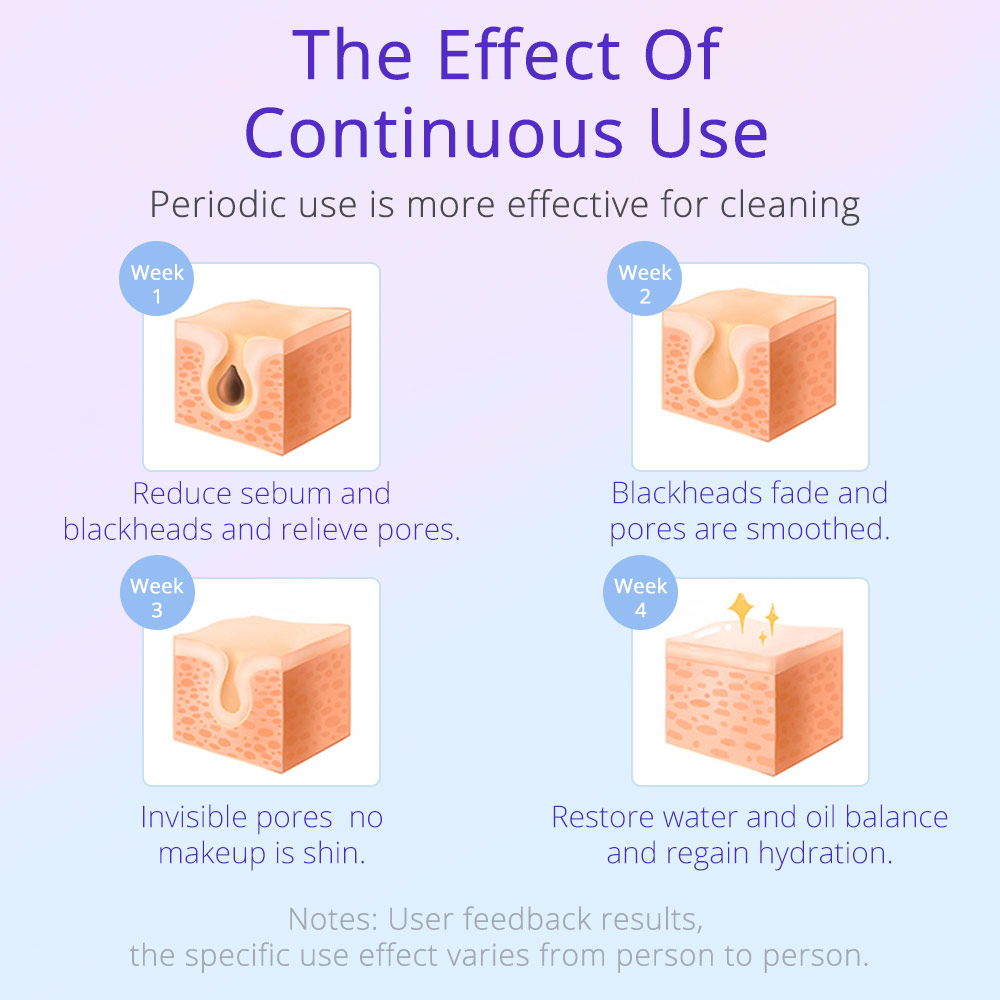 New Generation Microdermabrasion Skin Care Machine Exfoliator Face Lifting Anti Wrinkle Water Oxygen Facial Beauty Equipment