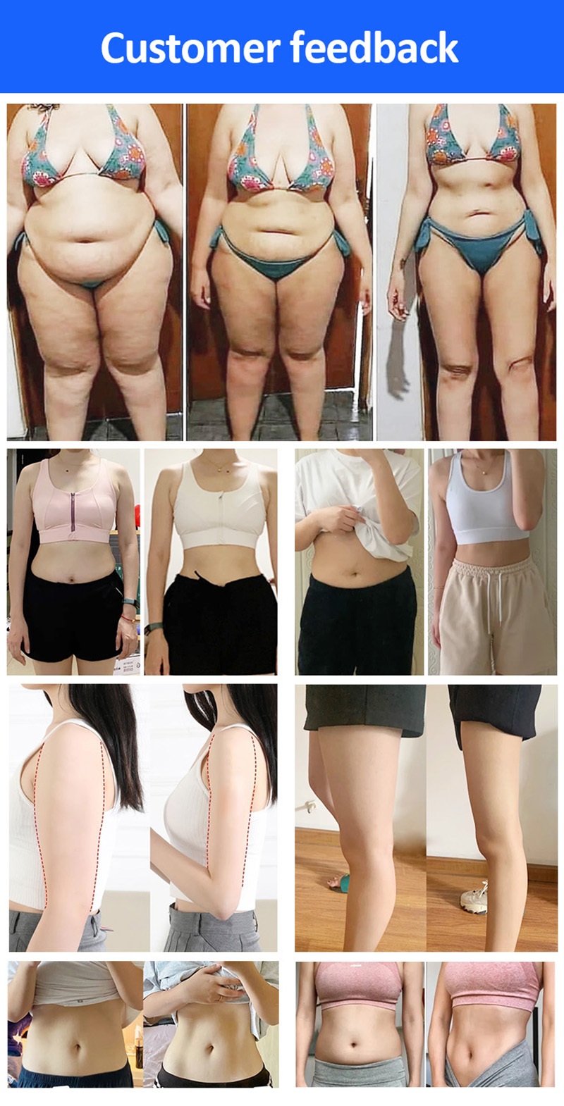 Premium Cryoskin Treatment System - Revolutionary Thermal Shock Method for Effective Fat Reduction & Skin Firming