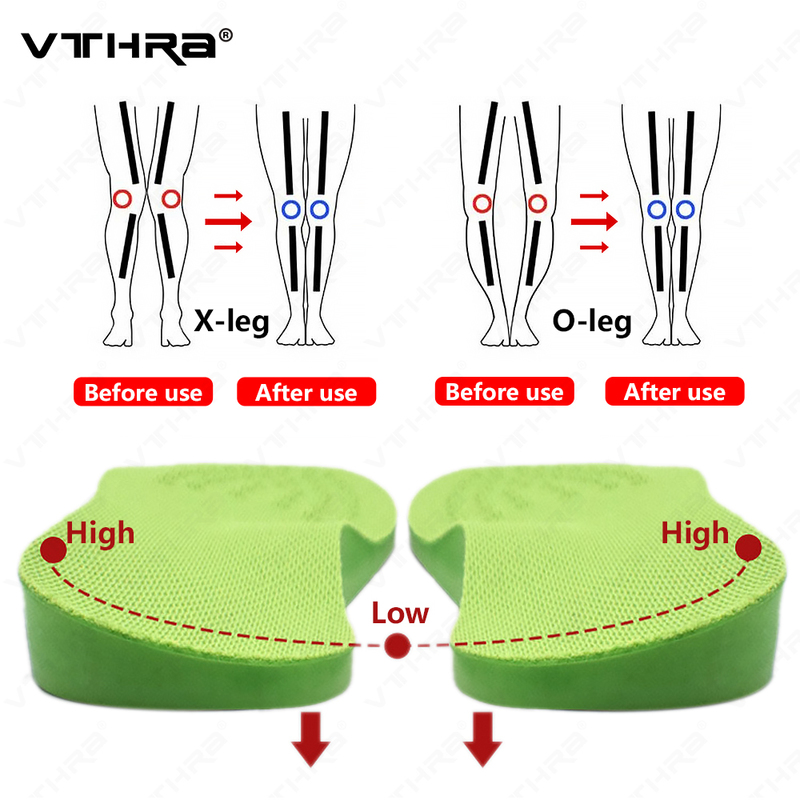 O X Leg Orthopedic Insoles Arch Support Insole Corrigibil Bow Legs Valgus Varus Massaging Shoe Pads Beauty Leg Feet Care Insert 220610
O X Leg Orthopedic Insoles Arch Support Insole Corrigibil Bow Legs Valgus Varus Massaging Shoe Pads Beauty Leg Feet Care Insert 220610